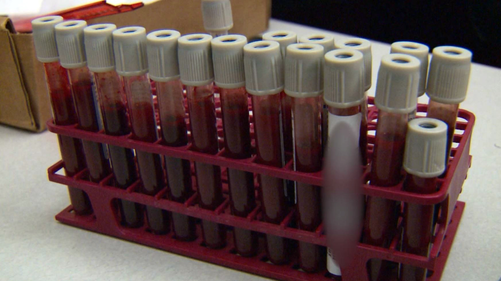 Austin Police Department APD DNA Lab - Blood Sample_298743